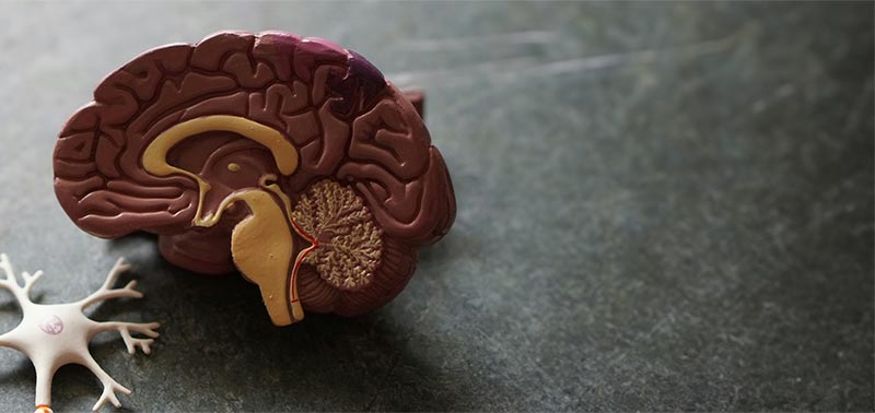 model of a brain